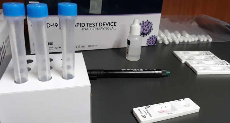 El Ayuntamiento de Plasencia comienza a realizar los test de antígenos a empleados municipales